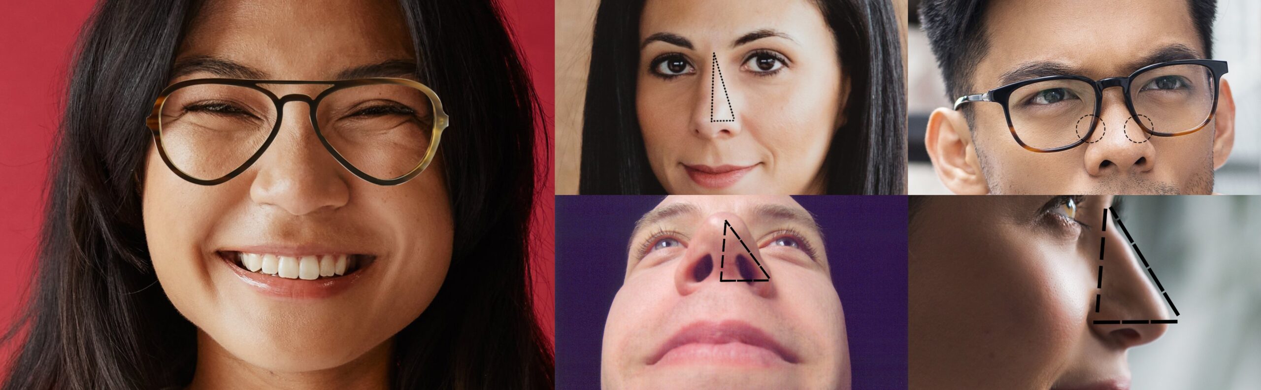 Nasal Angles